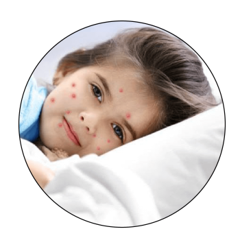Child-Diseases